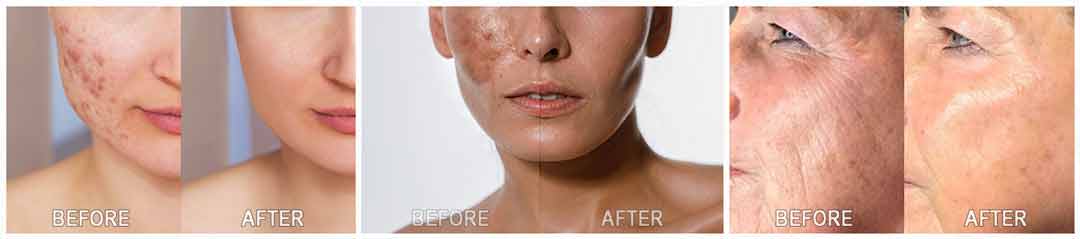 Skincare Protocol Review 1